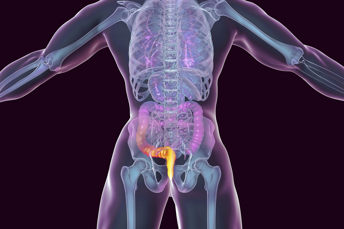 Cómo se realiza cirugía de fistula anal UCMA Quirónsalud Alicante