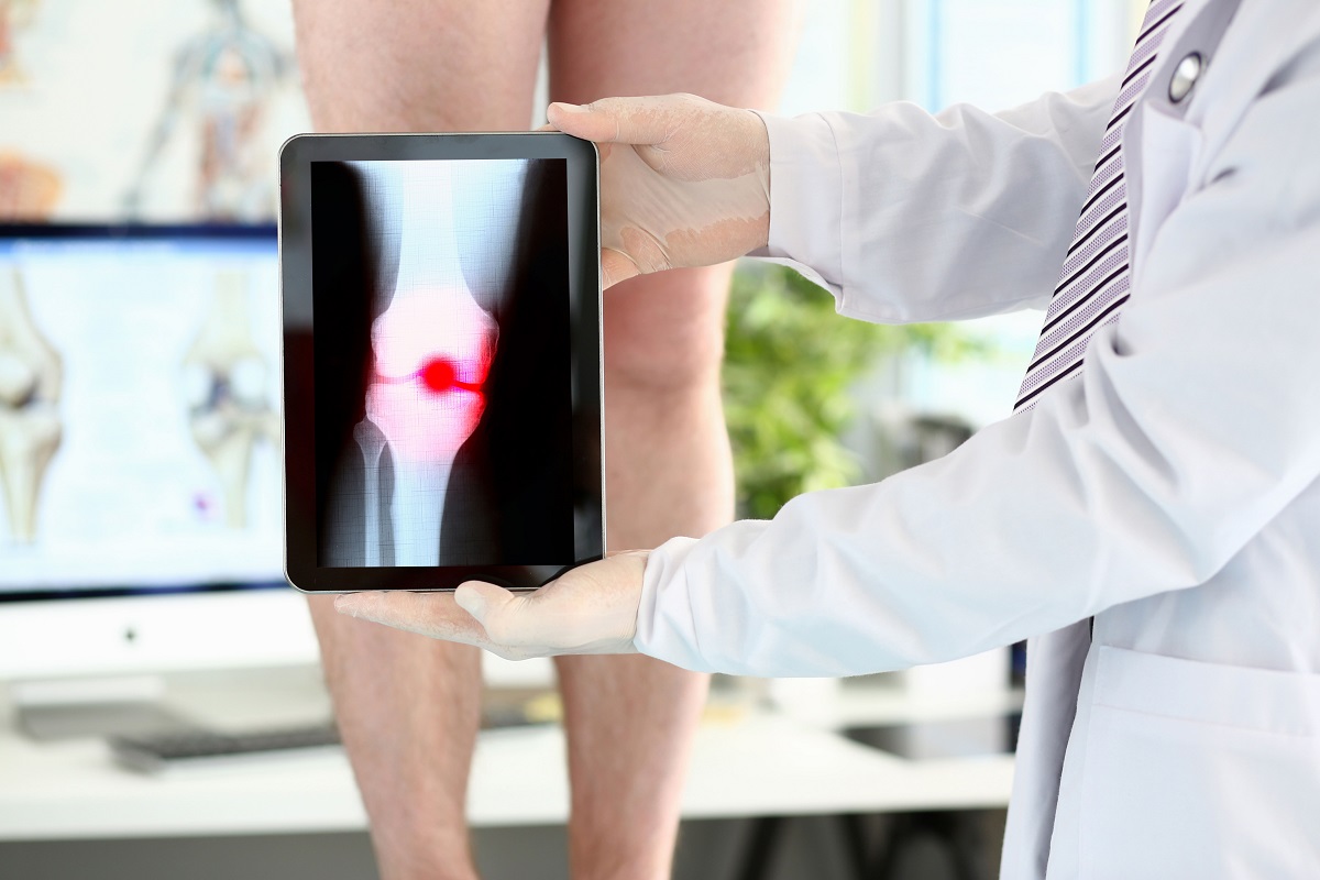 Cirugía mínimamente invasiva artroscopia Quirónsalud Alicante UCMA