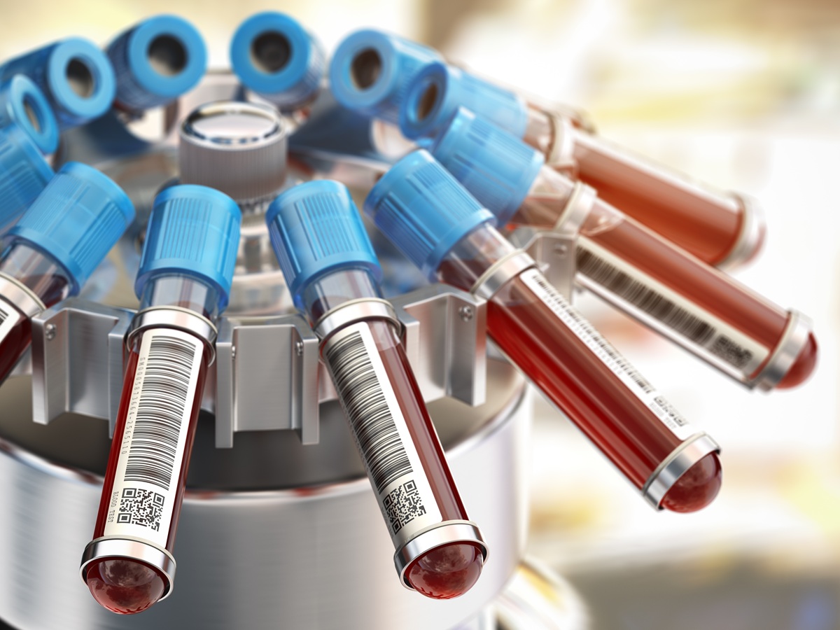 analisis clinicos snagre quironsalud alicante