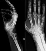 imagen de radiología