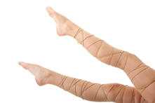 Varices – prevención/recomendaciones