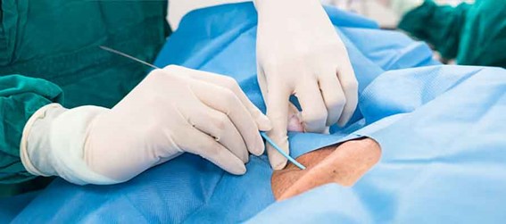 alargamiento prostatico