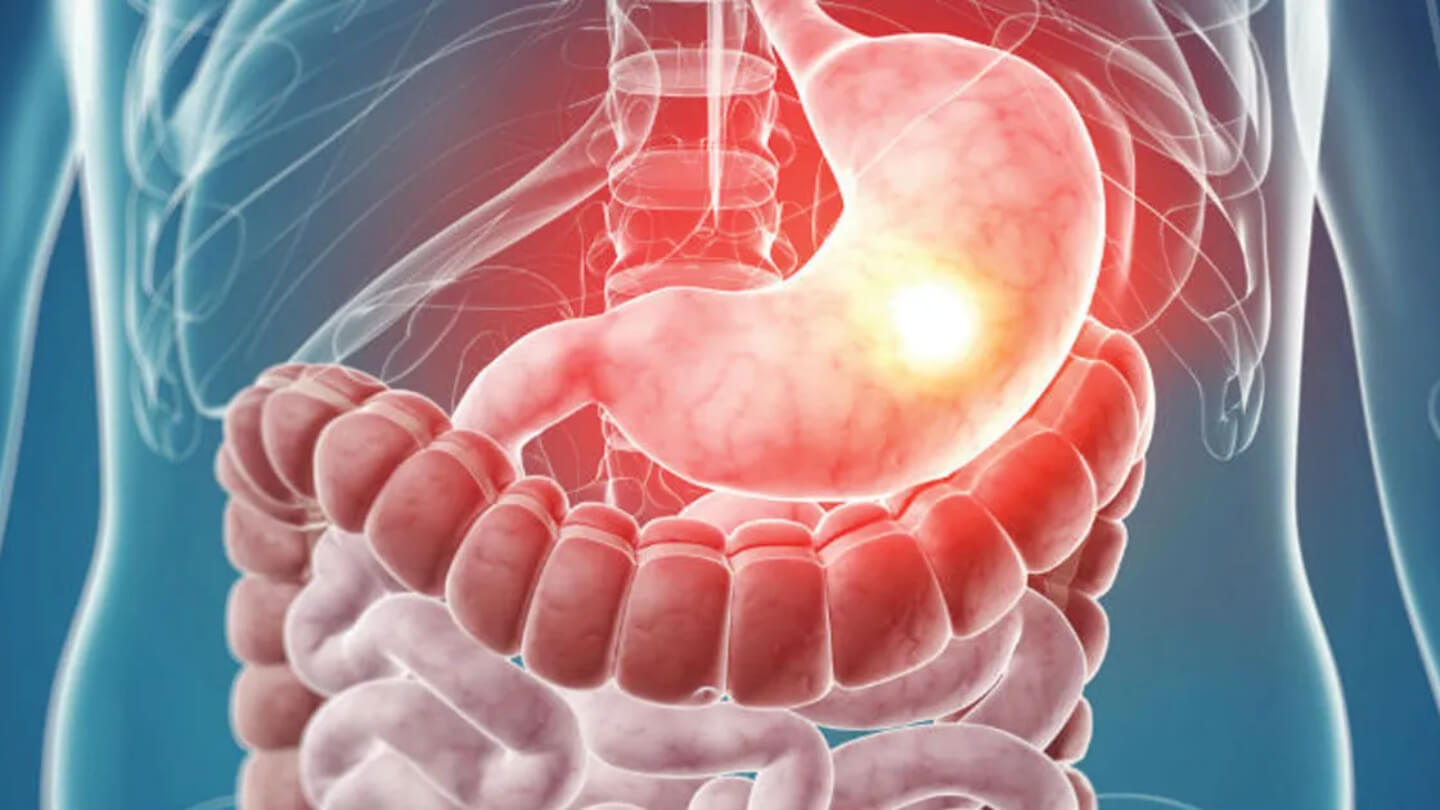 Que es la gastroenteritis