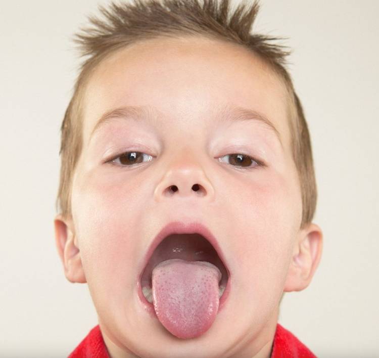 Sacar la lengua al asma