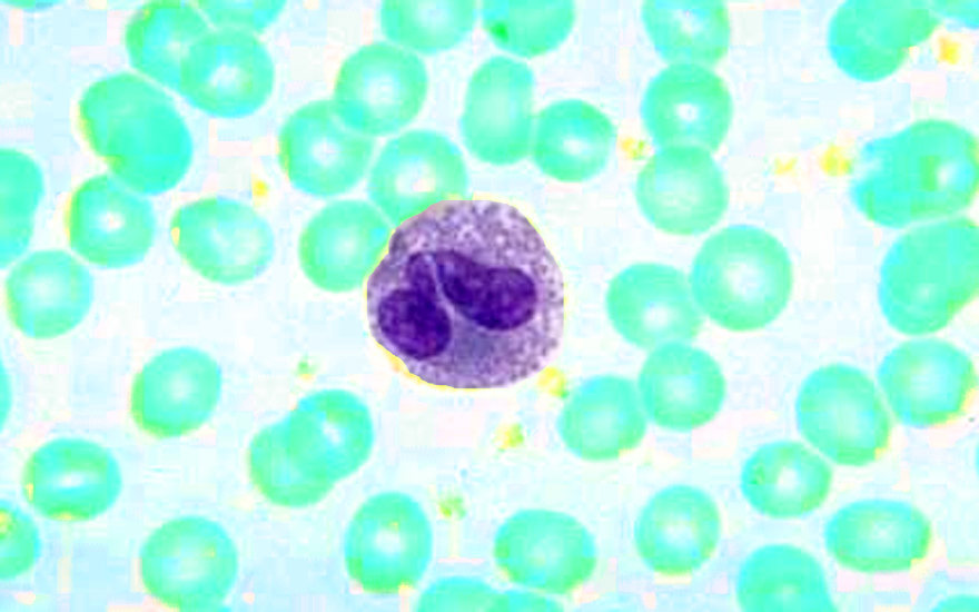 eosinofilo