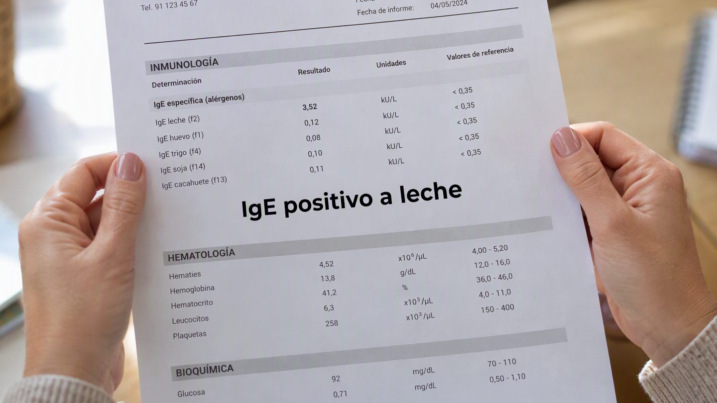 IGE positivo en leche