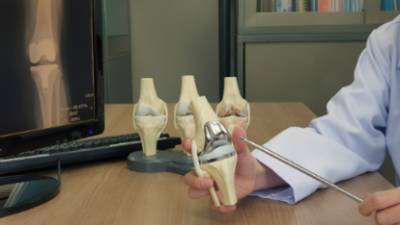 Prótesis de rodilla