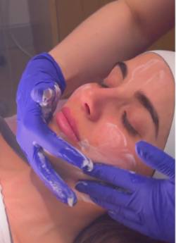2024 11 25 La importancia de la limpieza facial (1)