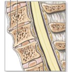 2022 06 22 Cefalea cervicogénica 1