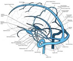 2021 05 12 Trombosis venosa cerebral 1