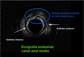 eco endoanal