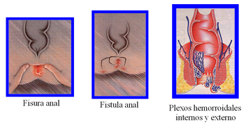 plexos hemorroidales