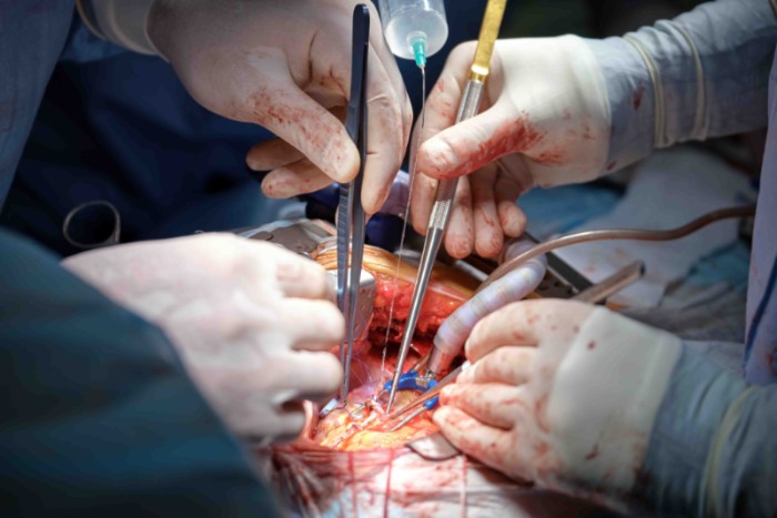 surgeons-performing-delicate-operation-in-hospital-2026-01-07-05-47-54-utc