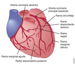 Coronariografía 1