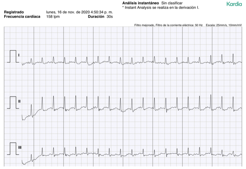 ECG24N