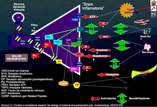 artritis2