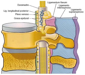 epidural4