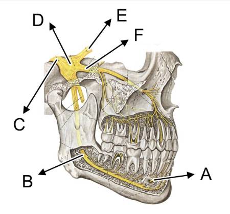 Neuralgia de trigémino