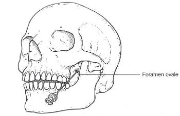 Neuralgia de trigémino