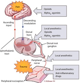 neuromodulacion3