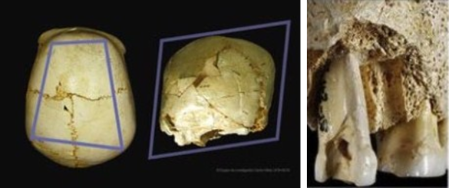 Paleontología del dolor_4