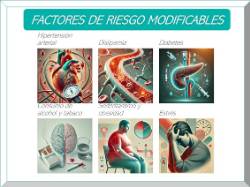 2024 11 18 Cuidar nuestra salud y prevenir el ictus