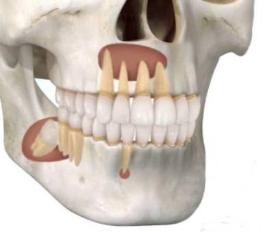 Cirugía Maxilofacial