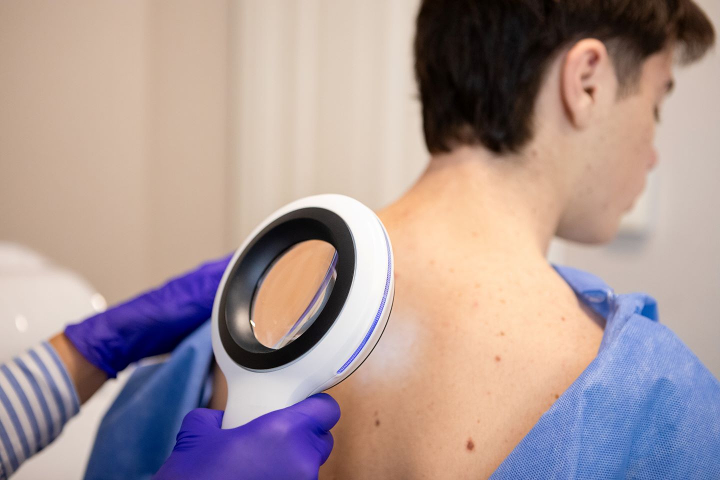 Revisiones dermatológicas