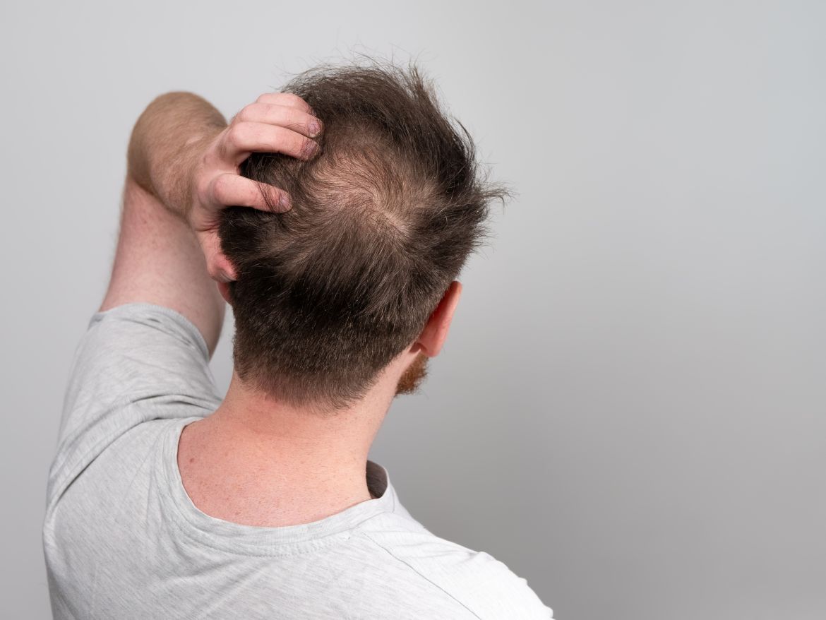 Caída pelo