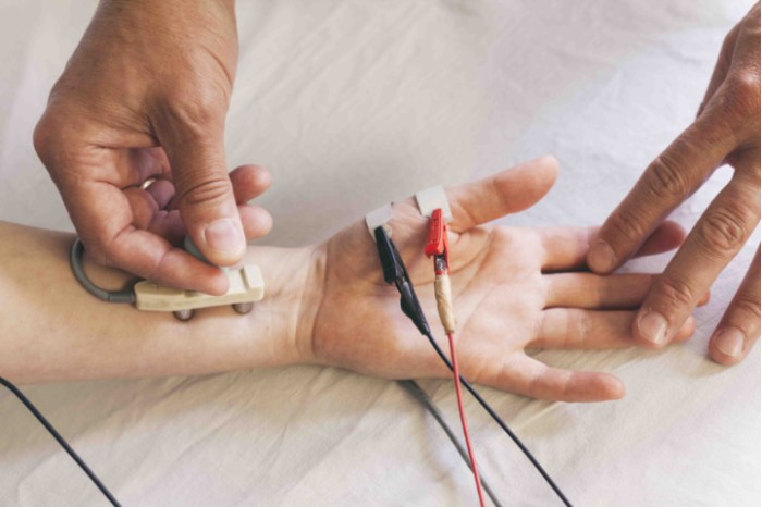 Electromiografía