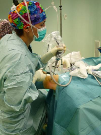 laparoscopia de rodilla