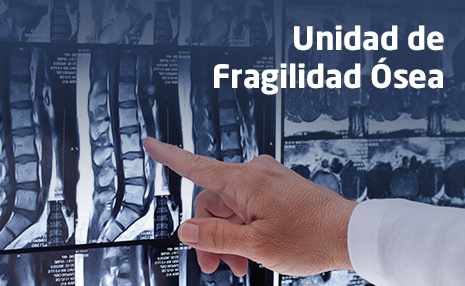 Destacado 465x286 Unidad de Fragilidad Ósea CACERES