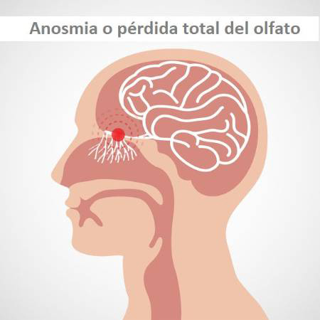 anosmia-perdida-olfato
