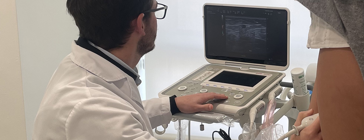 varices 2c web