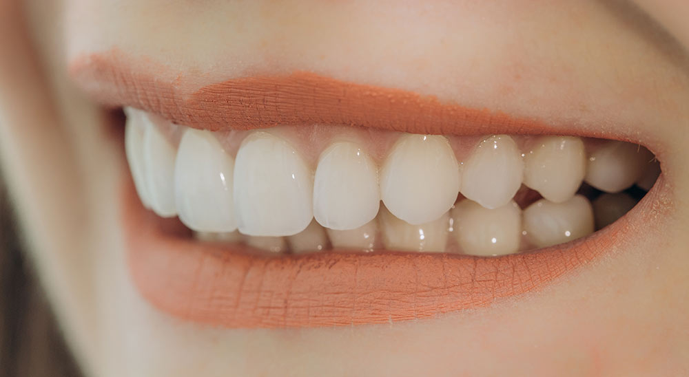 Estetica dental