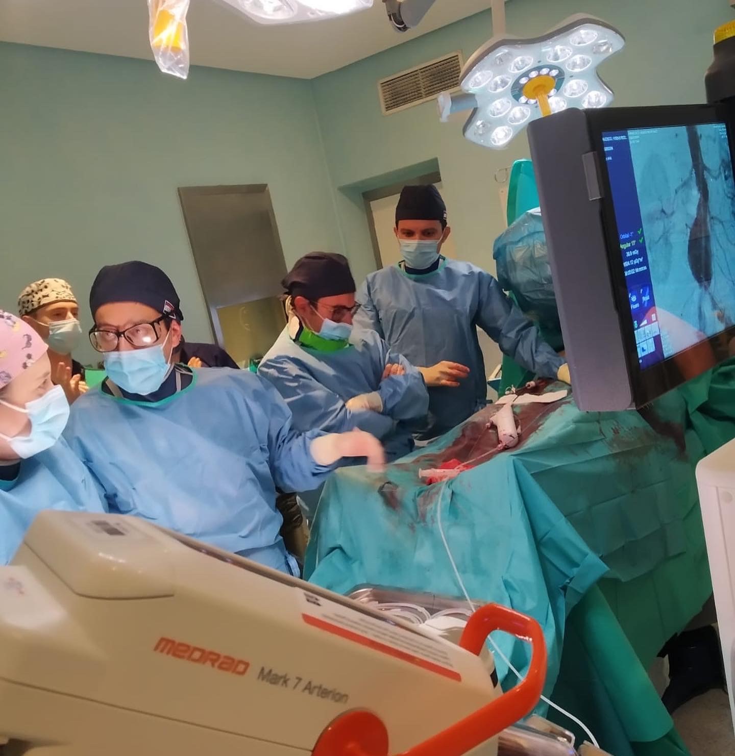 Intervencion aneurisma aorta abdominal Clideba