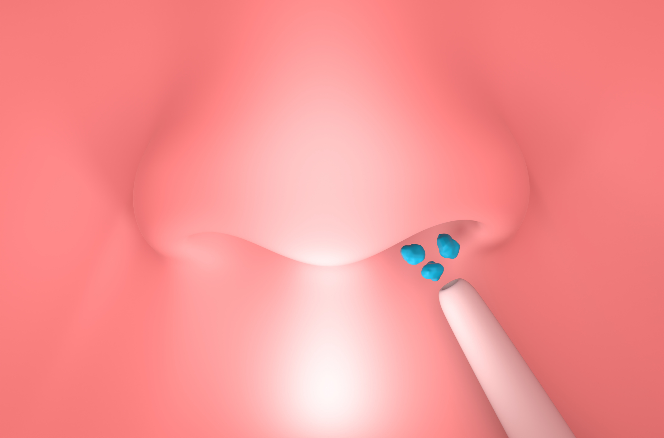 Foto perforación septal