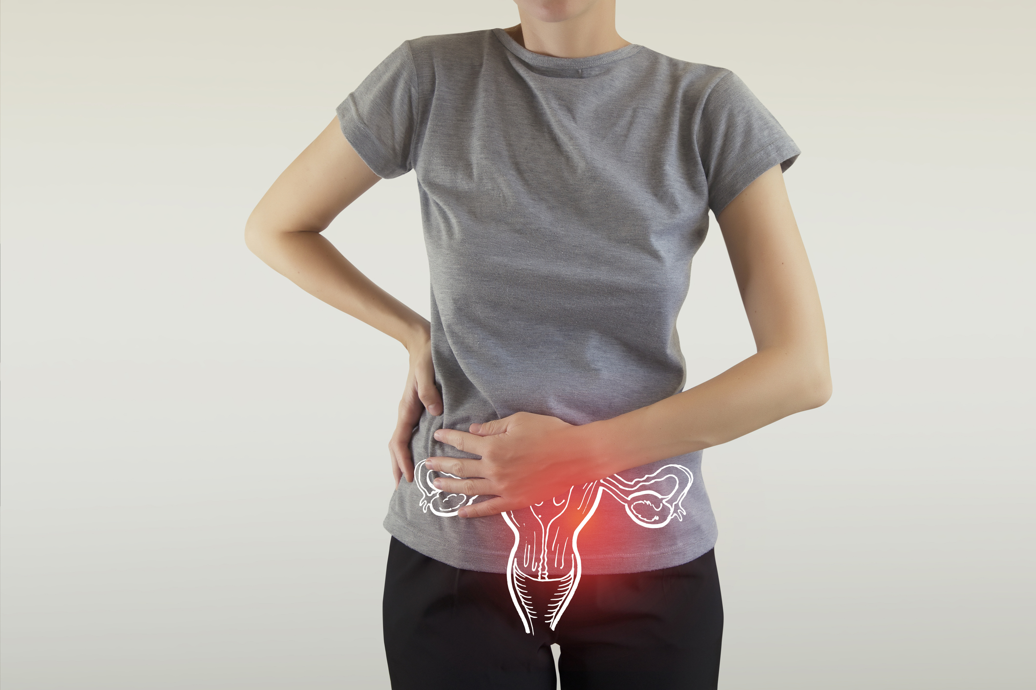 Foto cáncer de cérvix web