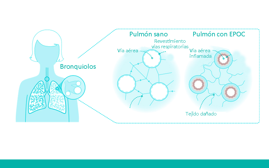 grafico_epoc_2