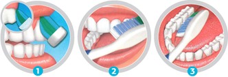 Pasos 1- 3