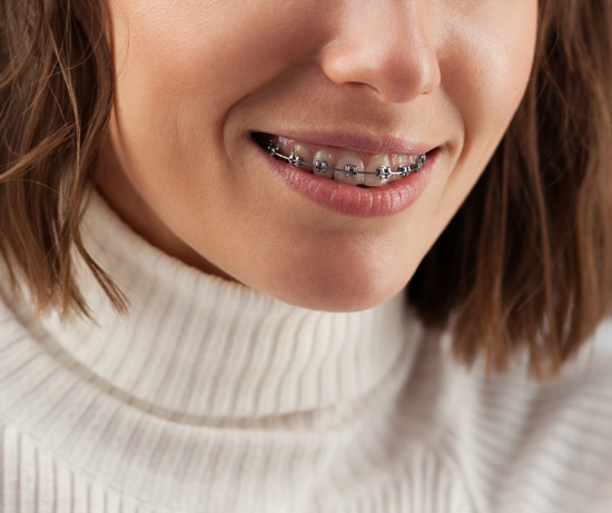 Brackets