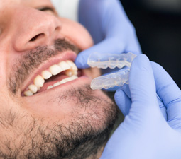 Invisalign