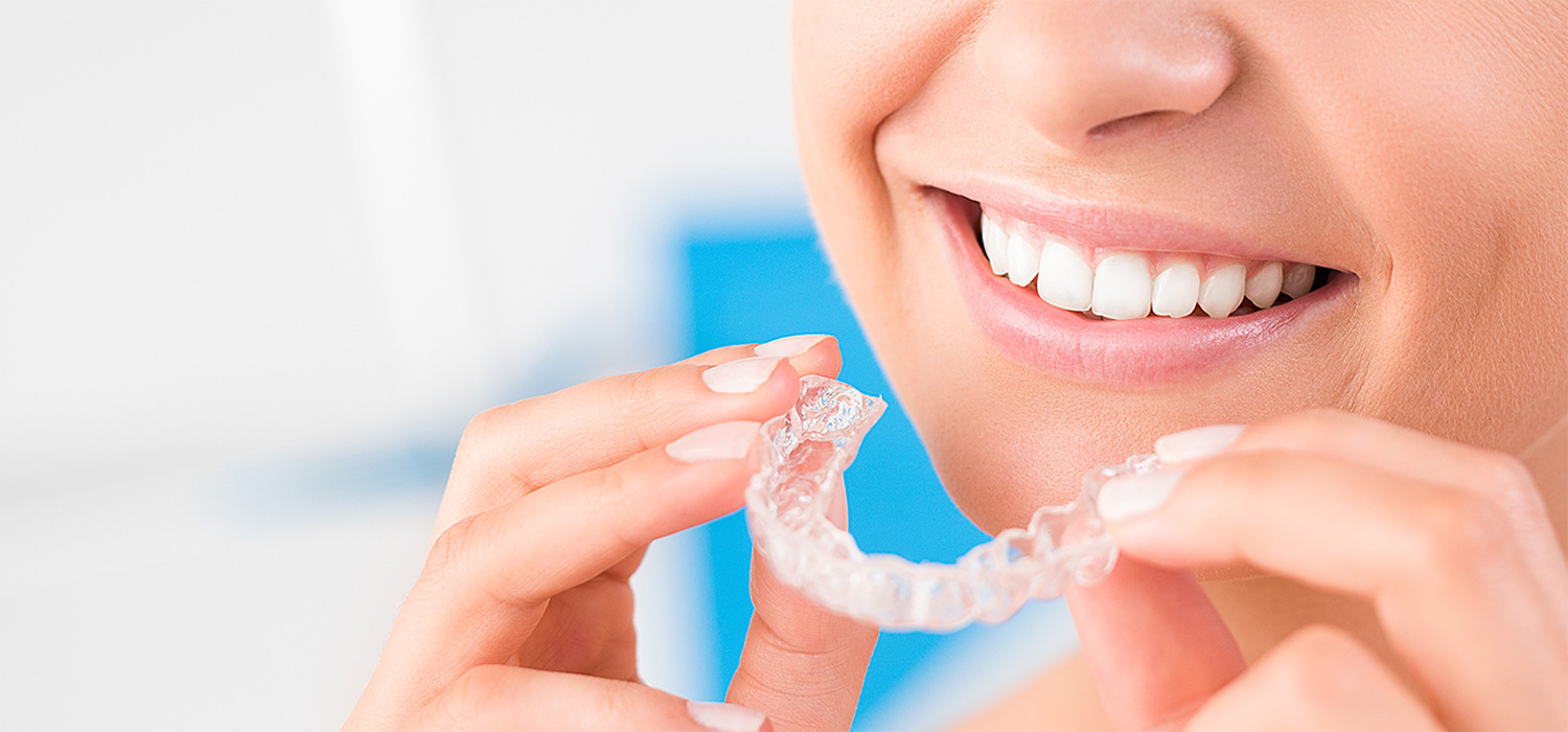 Invisalign