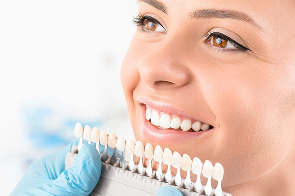 Tipos de carillas dentales