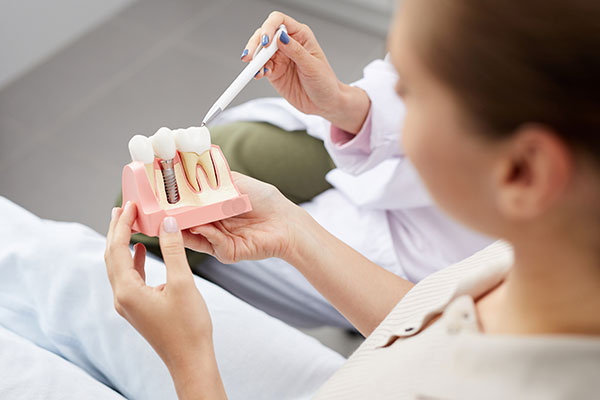 Para-qué-pacientes-están-indicados-los-implantes-dentales