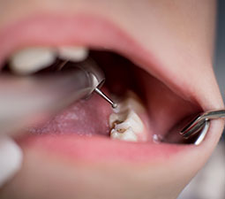 Listado-Endodoncia