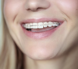 Listado-Brackets