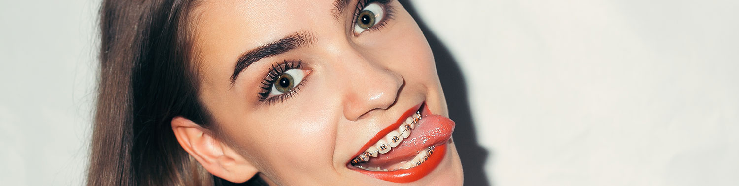 Brackets