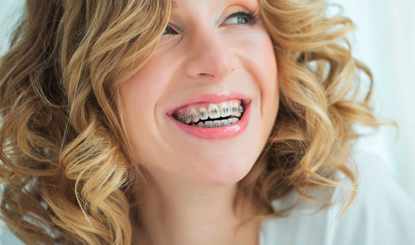 Brackets