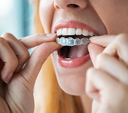 Listado-Invisalign